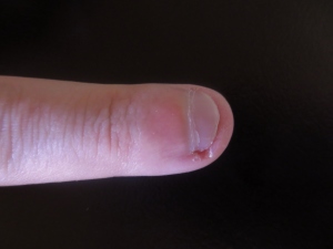 My fingernail before beginning the challenge. 